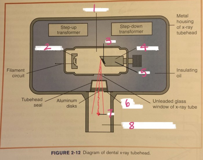 Label the components of the dental x ray tubehead