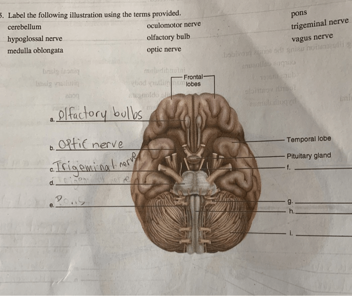 Label the muscles in the following illustration