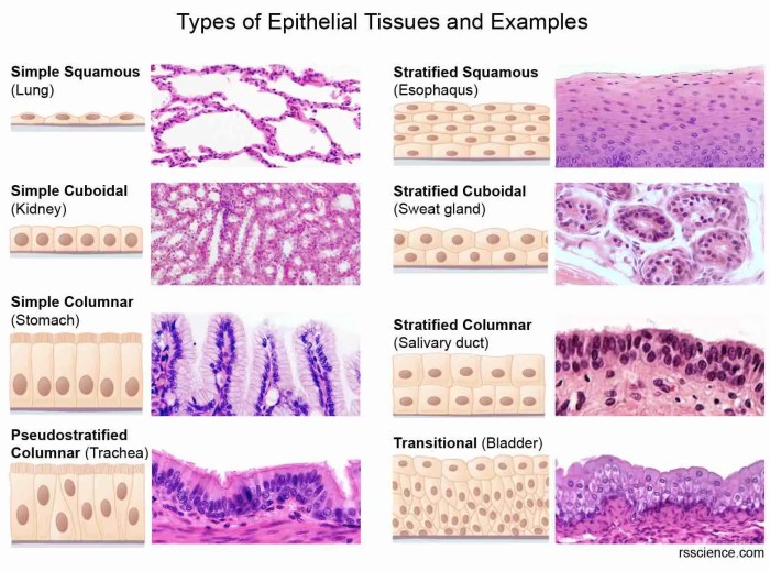 Match the type of simple epithelium with its description.